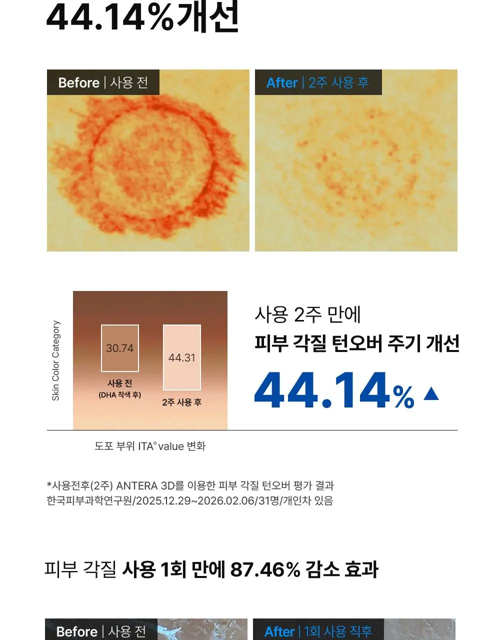 [단독기획] 동아제약 색소침착 프로 액제 30ml 기획(+크림제5ml) 상세페이지 11